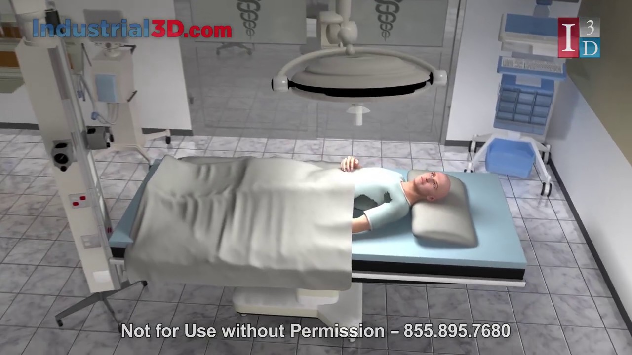 Smart Sutures 3D Medical Animation by Industrial3D | 3D Medical Tool Animation | 3D Medical Product